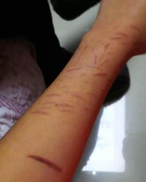 男生自残图片,男生心理困境的隐秘伤痕